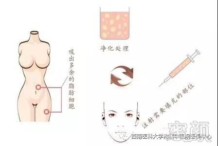 https://img.miyanlife.com/mnt/timg/180628/110GWA8-0.jpg