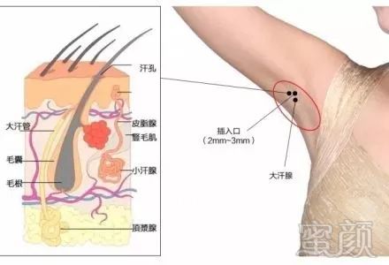 案例图片