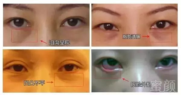 https://img.miyanlife.com/mnt/timg/180628/1123455E7-0.jpg