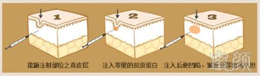 https://img.miyanlife.com/mnt/timg/180628/1131031159-10.jpg