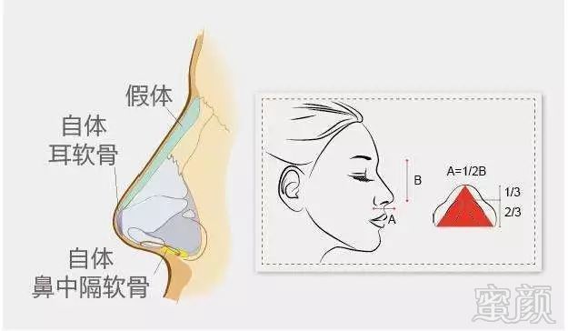 https://img.miyanlife.com/mnt/timg/180628/1135534029-2.jpg 案例图片