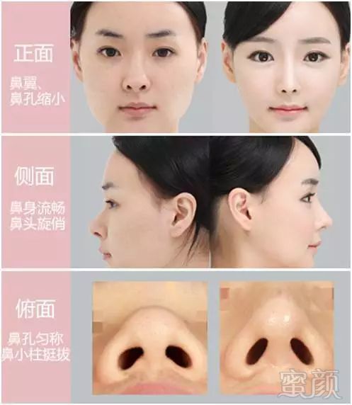 https://img.miyanlife.com/mnt/timg/180628/1135544G8-3.jpg 案例图片