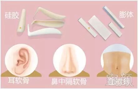 https://img.miyanlife.com/mnt/timg/180628/1135553263-4.jpg 案例图片