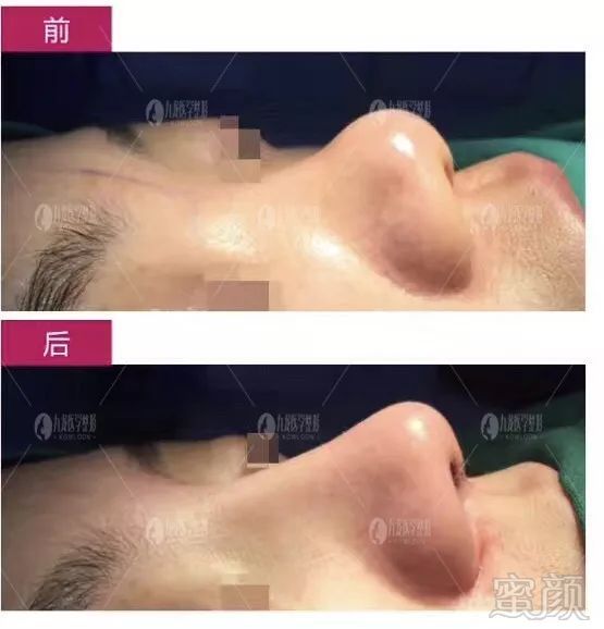 https://img.miyanlife.com/mnt/timg/180628/113600F47-7.jpg 案例图片