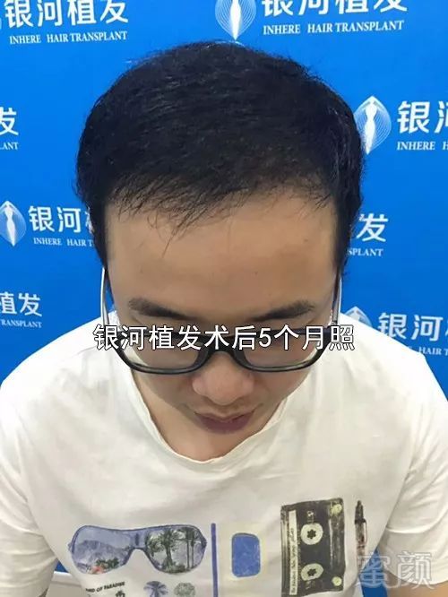https://img.miyanlife.com/mnt/timg/180628/1143491a9-7.jpg