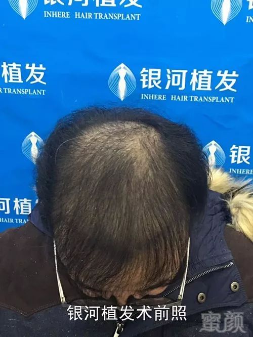 https://img.miyanlife.com/mnt/timg/180628/11434VE7-3.jpg