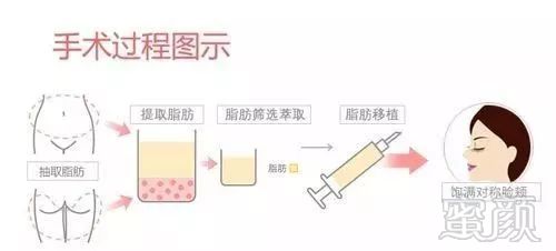 https://img.miyanlife.com/mnt/timg/180628/12010R057-8.jpg