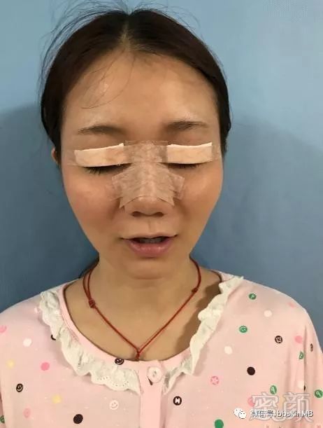 https://img.miyanlife.com/mnt/timg/180628/12012aU5-6.jpg