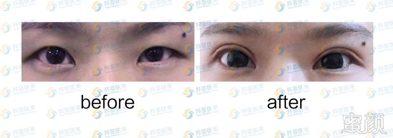 https://img.miyanlife.com/mnt/timg/180628/12323I413-0.jpg