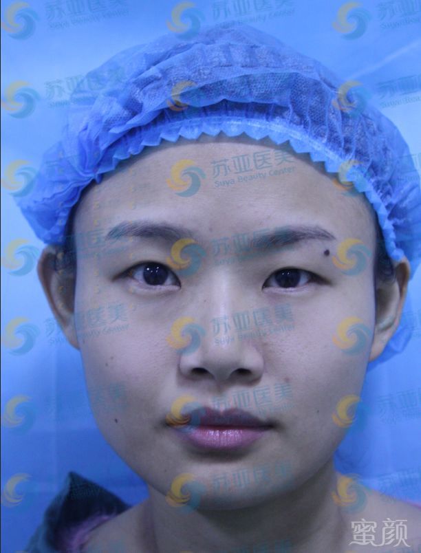 https://img.miyanlife.com/mnt/timg/180628/12323Kc0-1.jpg