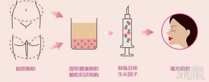 https://img.miyanlife.com/mnt/timg/180629/102ITL8-1.jpg