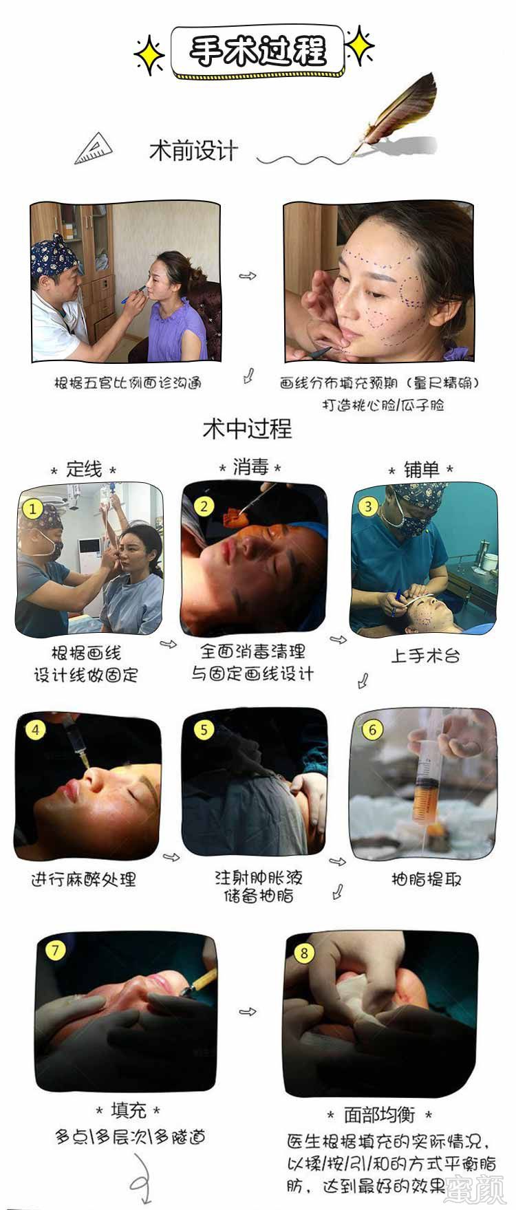 https://img.miyanlife.com/mnt/timg/180629/102Ia2V-5.jpg