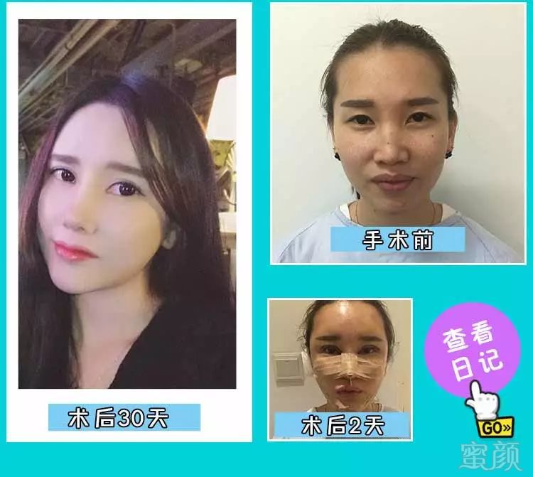 https://img.miyanlife.com/mnt/timg/180629/102J04300-7.jpg