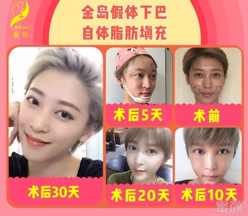 https://img.miyanlife.com/mnt/timg/180629/102J1B59-8.jpg