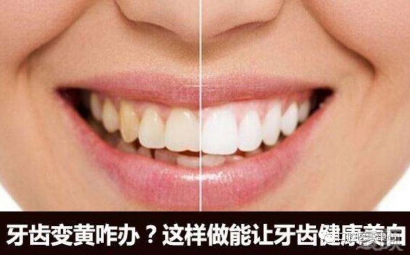https://img.miyanlife.com/mnt/timg/180629/1030251638-1.jpg