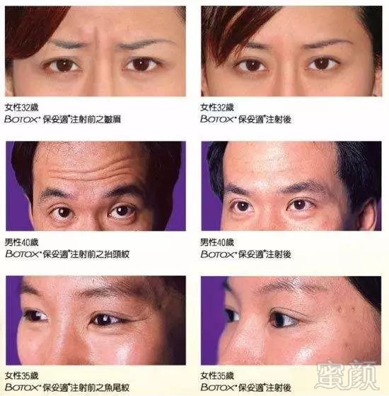 https://img.miyanlife.com/mnt/timg/180629/113T13c5-7.jpg