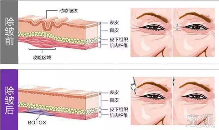 https://img.miyanlife.com/mnt/timg/180629/113T1O35-6.jpg
