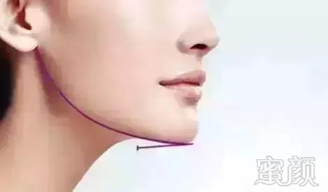 https://img.miyanlife.com/mnt/timg/180629/113T26205-12.jpg