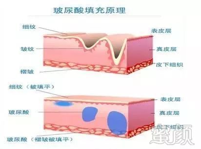 案例图片