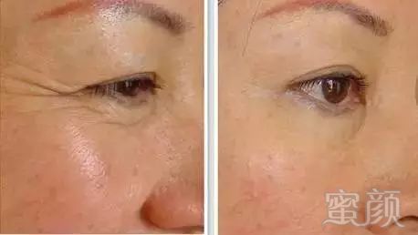 https://img.miyanlife.com/mnt/timg/180629/1152255562-8.jpg