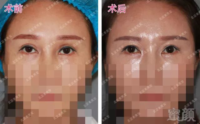 https://img.miyanlife.com/mnt/timg/180629/1204513305-1.jpg