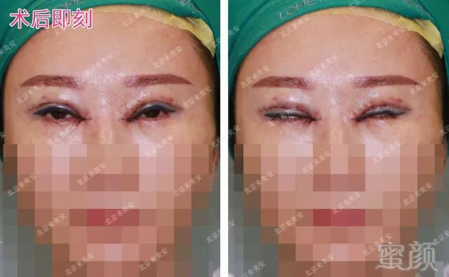 https://img.miyanlife.com/mnt/timg/180629/1204525352-3.jpg