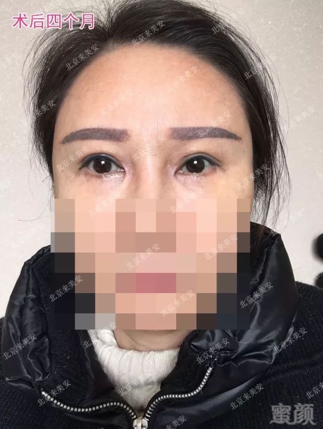 https://img.miyanlife.com/mnt/timg/180629/1204525F8-4.jpg