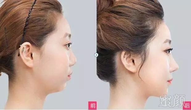 https://img.miyanlife.com/mnt/timg/180629/12055G141-3.jpg