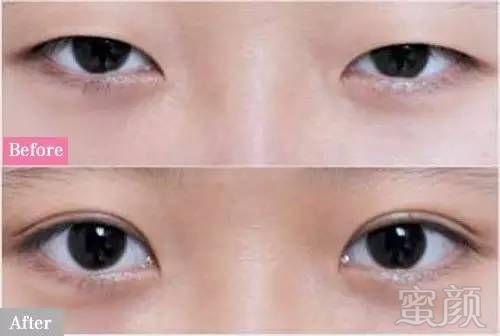 https://img.miyanlife.com/mnt/timg/180629/1222424W0-8.jpg