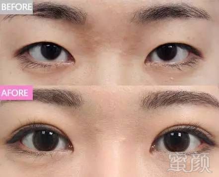 https://img.miyanlife.com/mnt/timg/180629/122242G64-7.jpg