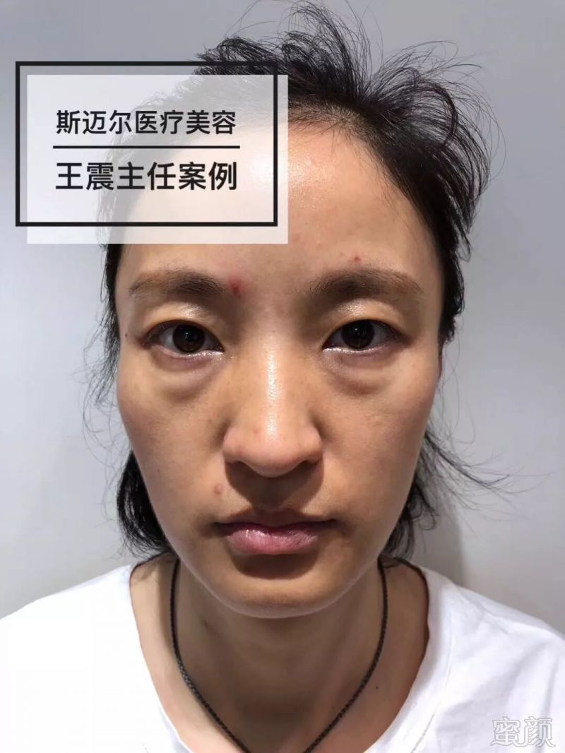 https://img.miyanlife.com/mnt/timg/180629/12254AT2-2.jpg