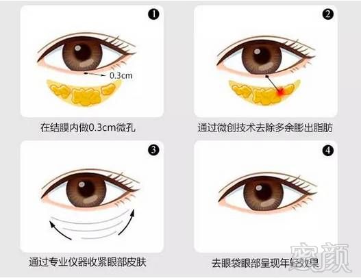 https://img.miyanlife.com/mnt/timg/180629/12254QG5-3.jpg
