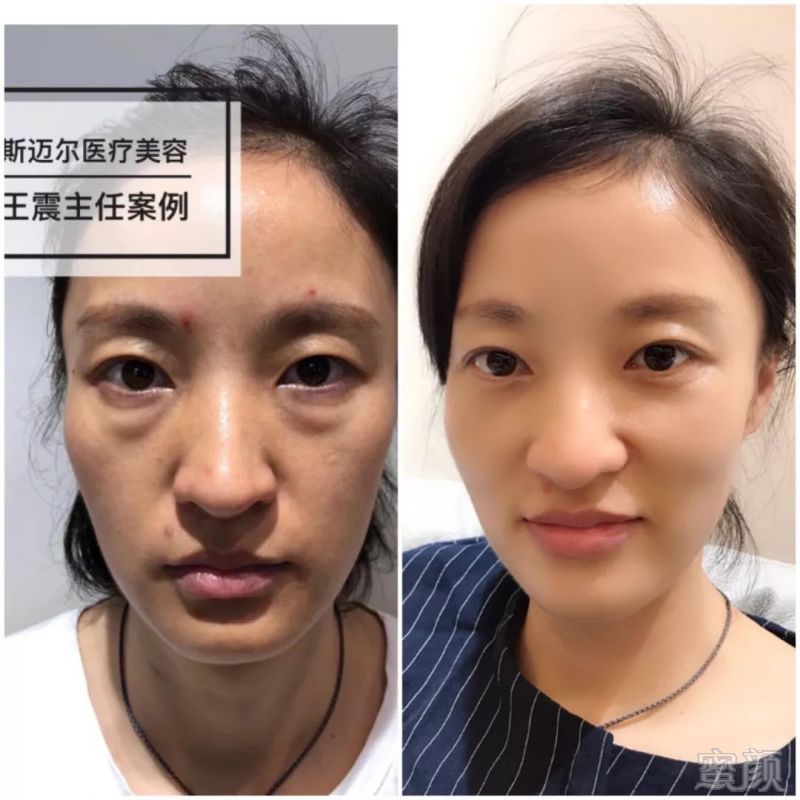 https://img.miyanlife.com/mnt/timg/180629/1226055251-9.jpg