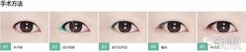 https://img.miyanlife.com/mnt/timg/180629/1226064429-6.jpg