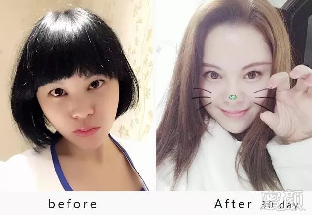 https://img.miyanlife.com/mnt/timg/180629/1226096330-10.jpg