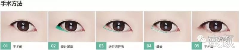https://img.miyanlife.com/mnt/timg/180629/12260M3S-7.jpg