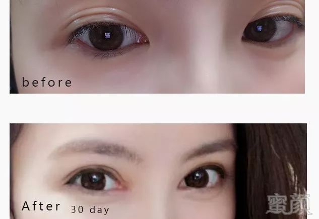 https://img.miyanlife.com/mnt/timg/180629/12260SY3-9.jpg