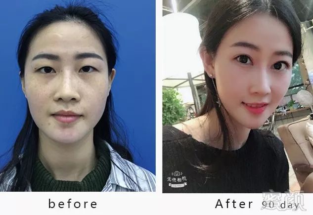 https://img.miyanlife.com/mnt/timg/180629/1226106122-11.jpg