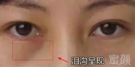 https://img.miyanlife.com/mnt/timg/180629/1230033O8-6.jpg