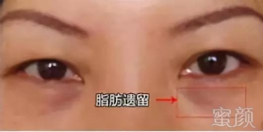 https://img.miyanlife.com/mnt/timg/180629/1230035031-7.jpg
