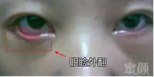 https://img.miyanlife.com/mnt/timg/180629/12300353U-9.jpg