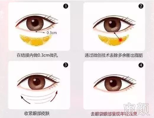 https://img.miyanlife.com/mnt/timg/180629/1230041221-11.jpg