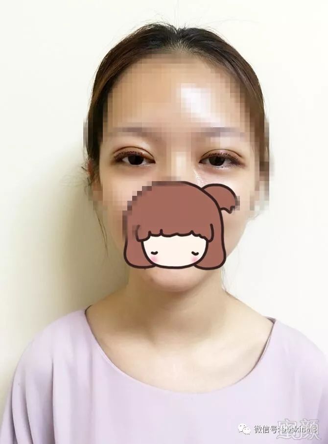 https://img.miyanlife.com/mnt/timg/180629/1230594556-2.jpg