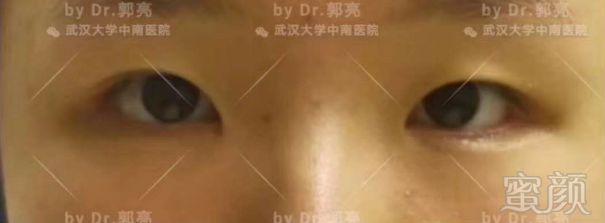 https://img.miyanlife.com/mnt/timg/180629/12364JU1-0.jpg