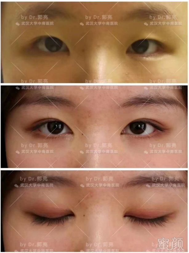 https://img.miyanlife.com/mnt/timg/180629/12364L347-2.jpg