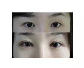 https://img.miyanlife.com/mnt/timg/180629/1246003A7-2.jpg