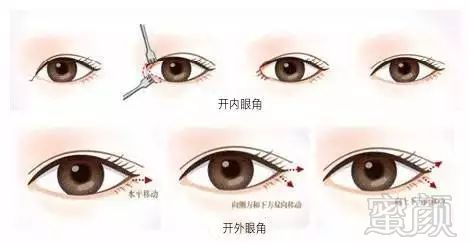 https://img.miyanlife.com/mnt/timg/180629/1246012027-4.jpg