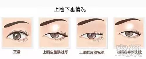https://img.miyanlife.com/mnt/timg/180629/1246016347-6.jpg