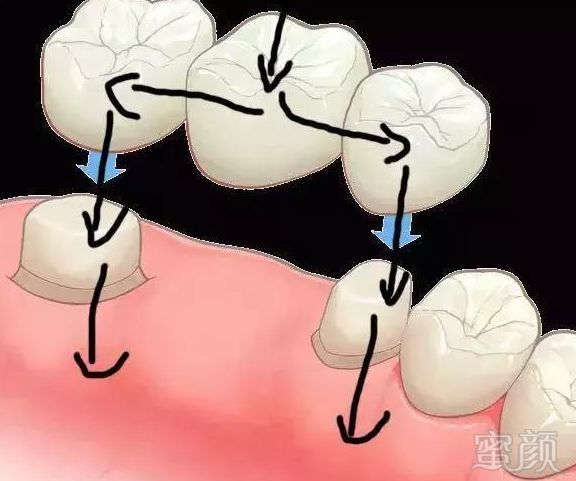 https://img.miyanlife.com/mnt/timg/180630/11393234a-1.jpg