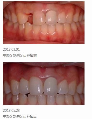 https://img.miyanlife.com/mnt/timg/180630/1139334300-2.jpg